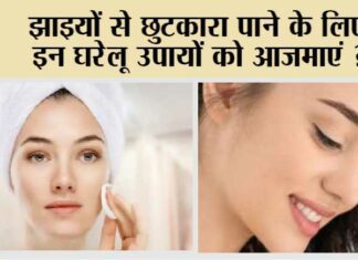 Home Remedies for Pigmentation: झाइयों से छुटकारा पाये सिर्फ़ 7 दिनों में ! Home Remedies for Pigmentation
