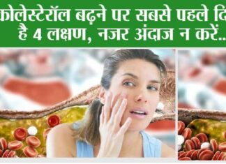 Signs of High Cholesterol