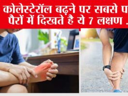 Signs of high cholesterol in legs