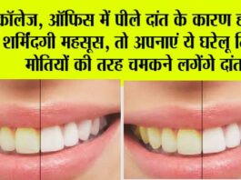 Teeth Whitening Tips