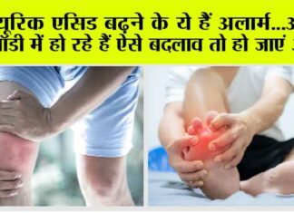 Uric Acid Symptoms
