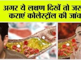 Warning Sign Of High Cholesterol