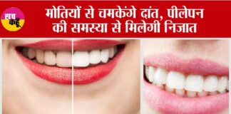 Yellow Teeth Home Remedies