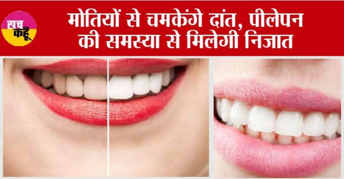 Yellow Teeth Home Remedies