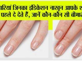 nails indication
