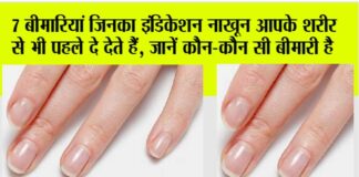nails indication