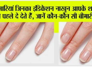 nails indication
