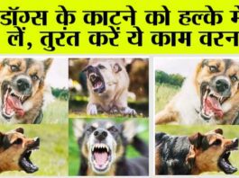 Dog Bite: कुत्ता के काटने पर क्या करें और क्या न करें, जानिए क्या सावधानी बरतें, लापरवाही न बरतें Dog Bite