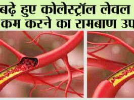 How to reduce Cholesterol: बढ़े हुए कोलेस्ट्रॉल लेवल को कैसे कम करें? How to reduce Cholesterol