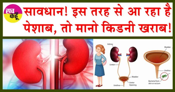 Kidney Disease