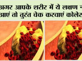 Signs your arteries full of cholesterol