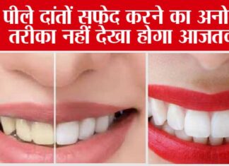 Teeth Cleaning in only 5 Minutes