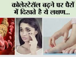What Are Signs of High Cholesterol: कोलेस्टेरॉल बढ़ने पर पैरों में दिखते है ये लक्षण… What Are Signs of High Cholesterol