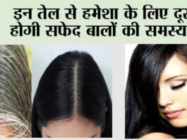 White Hair Treatment: सफेद बालों से पाना है छुटकारा तो अभी से इन हेयर तेल का करें इस्तेमाल! White Hair Treatment