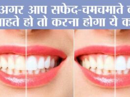 White Teeth Home Remedy