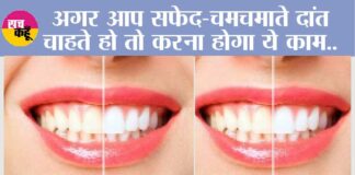 White Teeth Home Remedy