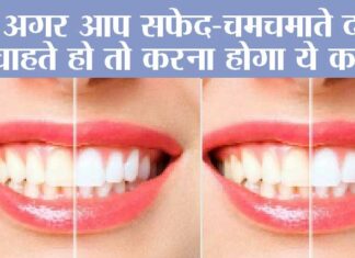 White Teeth Home Remedy