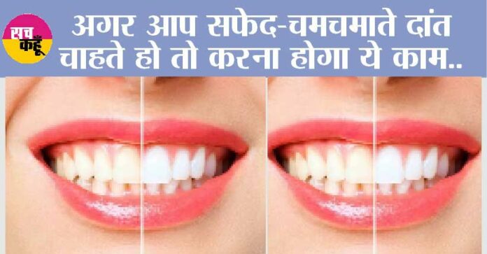 White Teeth Home Remedy