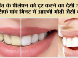 Whiten Teeth Naturally
