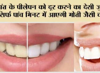 Whiten Teeth Naturally