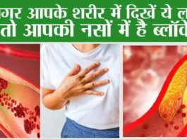 Blockage in Veins Symptoms: अगर आपके शरीर में दिखें ये लक्षण, तो आपकी नसों में है ब्लॉकेज Blockage in Veins Symptoms