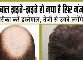 Hair Fall Home Remedies