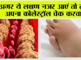 Signs your arteries full of Cholesterol