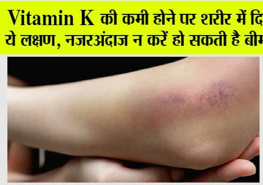 Vitamin K Deficiency: Vitamin K की कमी होने पर शरीर में दिखते हैं ये लक्षण, नजरअंदाज न करें हो सकती है बीमारियां Vitamin K Deficiency