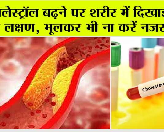 High Cholesterol Symptoms