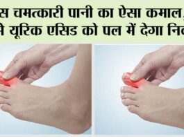 Uric Acid Control: