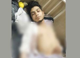 नमाज़ पढ़ते किशोर को चाकू मारकर किया घायल Bulandshahr News