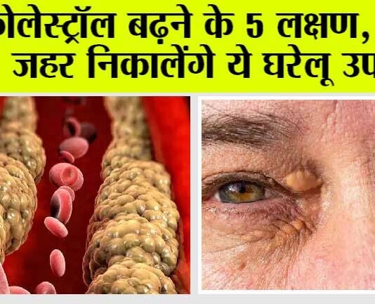 Signs of Cholesterol