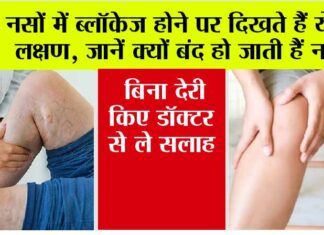 Symptoms of Veins Blockage