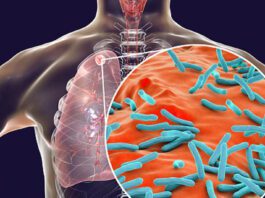 Haryana News: पांच साल में हरियाणा में टीबी का एक भी मामला नहीं Haryana News