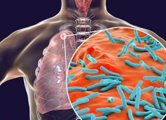 Haryana News: पांच साल में हरियाणा में टीबी का एक भी मामला नहीं Haryana News