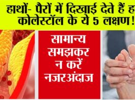 High Cholesterol Symptoms