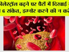 Cholesterol Symptoms