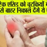 Foods For Uric Acid