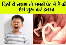 Stomach Worms Remedies
