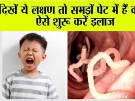 Stomach Worms Remedies