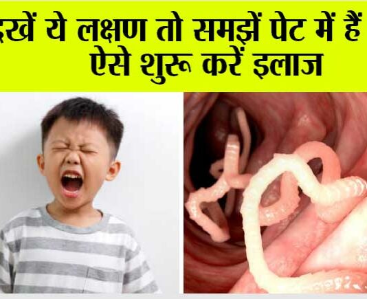 Stomach Worms Remedies