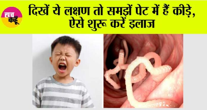 Stomach Worms Remedies