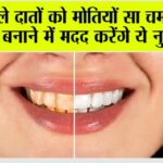 Teeth Cleaning Remedies