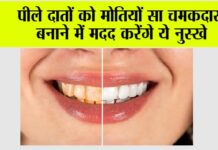Teeth Cleaning Remedies