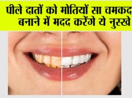 Teeth Cleaning Remedies