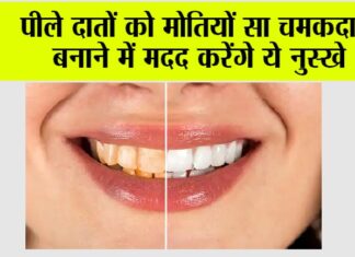 Teeth Cleaning Remedies