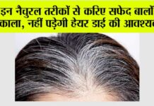 White Hair Remedies