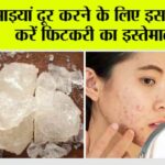 Fitkari for Dark Spots