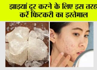 Fitkari for Dark Spots