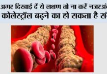 High Cholesterol Signs